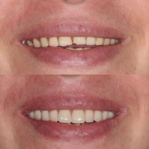 Dentista Santo Amaro