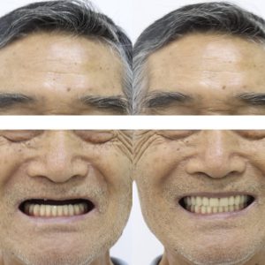 Dentista em Santo Amaro